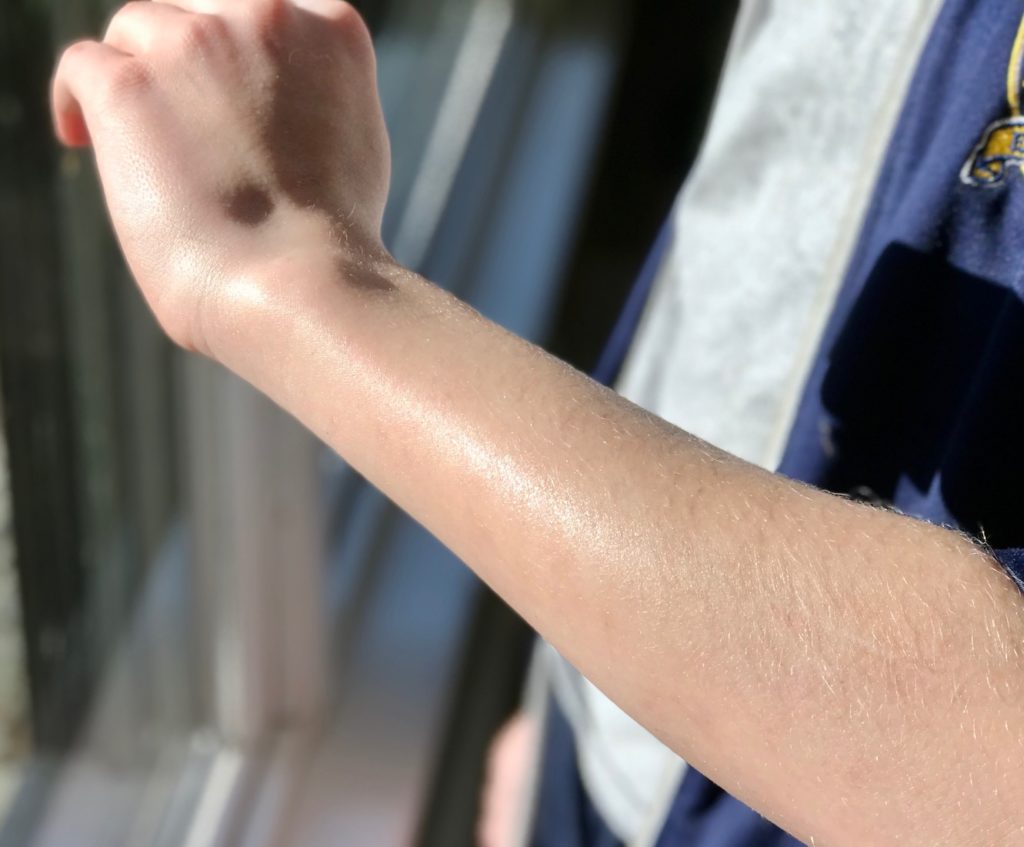 Healthy sheen of moisturized skin after the body butter is spread on the arm.